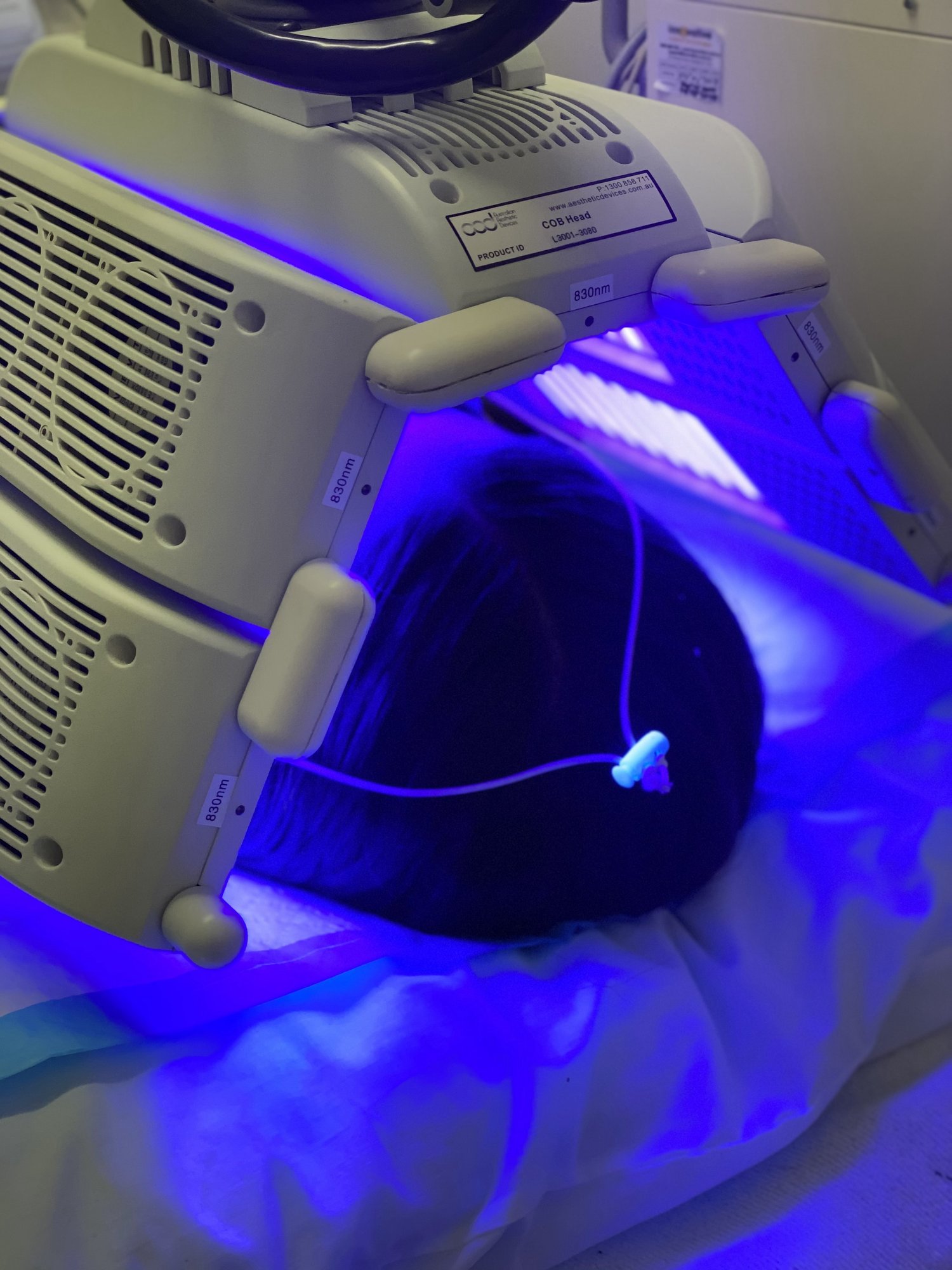 Blue LED light therapy treatment for acne Blue LED light therapy treatment for acne