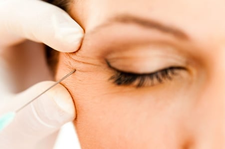 AWI-injection-in-crows-feet-migraines-1024x681 AWI-injection-in-crows-feet-migraines-1024x681