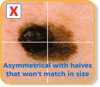 Asymmetrical