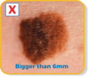 Bigger than 6mm