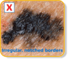 Irregular borders