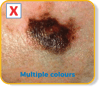 Multiple colours