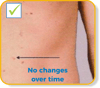 No changes over time
