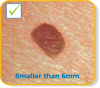 Smaller than 6mm