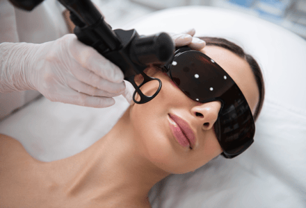 Laser resurfacing