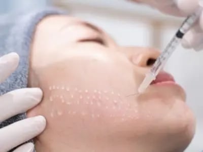 Mesotherapy