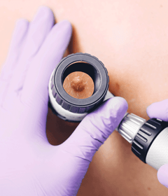 NSRC-Skin-cancer-checks-webpage__600x700px NSRC-Skin-cancer-checks-webpage__600x700px