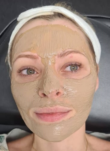 Cosmelan depigmentation woman face 2