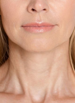 Bio-remodelling treatments image 4