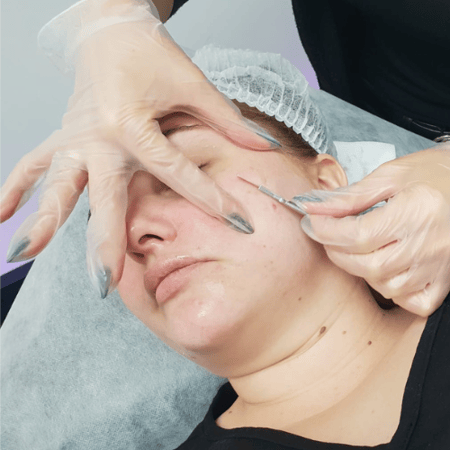 Dermaplaning womans cheek