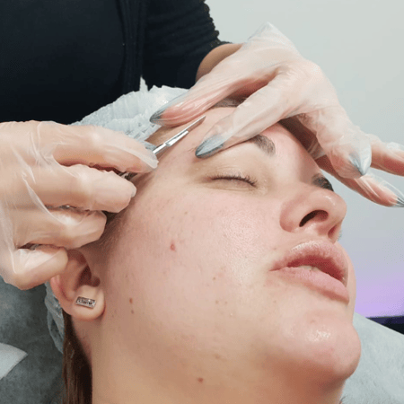 Dermaplaning womans forehead