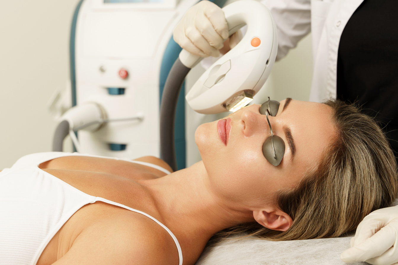 IPL for pigmentation and rejuv  1