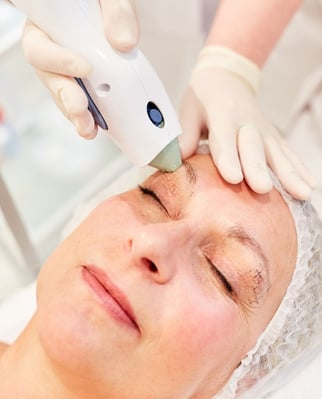 Information on the new thermage CPT treatment