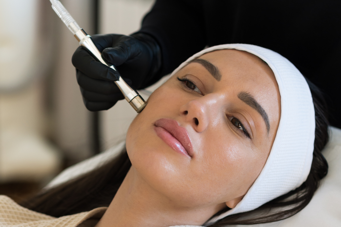 Microdermabrasion