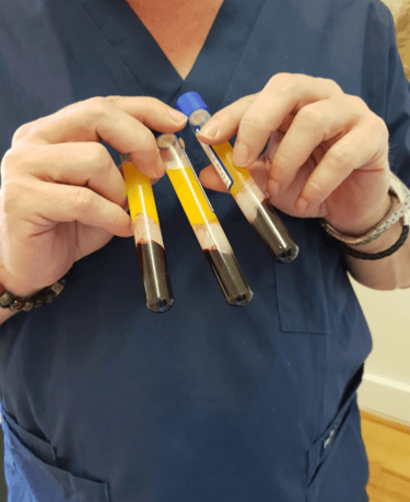 PRP therapy vials