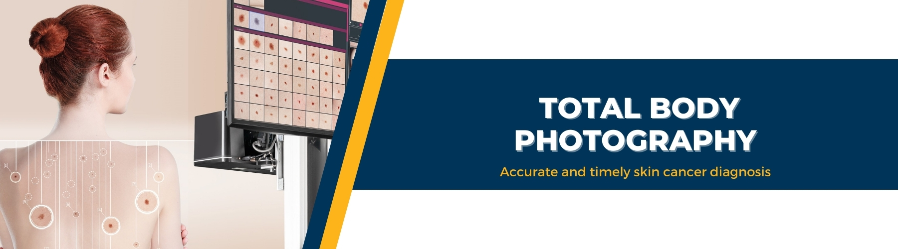 Total Body Photography Redcliffe Skin Cancer Centre