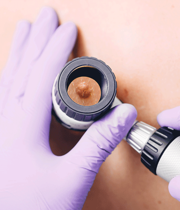NSRC-Skin-cancer-checks-webpage__600x700px NSRC-Skin-cancer-checks-webpage__600x700px