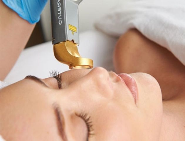 Laser skin rejuvenation image